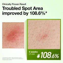 Anua Azelaic Acid10 Hyaluron Redness Soothing, serum kojące, 30 ml