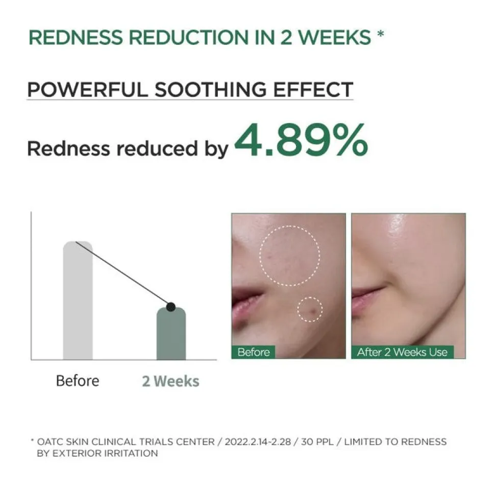 Anua Heartleaf 80% Ampoule, ampułka do twarzy, 30 ml