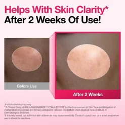 Anua Niacinamide 10% + TXA 4%, serum rozjaśniające i redukujące przebarwienia, 30 ml
