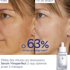 Caudalie Vinoperfect, serum rozjaśniające przebarwienia, 30 ml