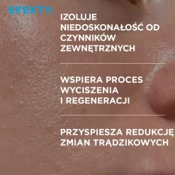 Idee Derm, żel punktowy na wypryski, 15 ml