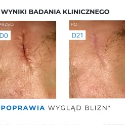 Uriage Bariederm CICA, krem regenerujący z Cu-Zn, 40 ml